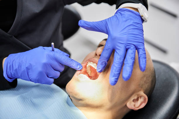 Best Emergency Wisdom Tooth Extraction in Dumont, NJ
